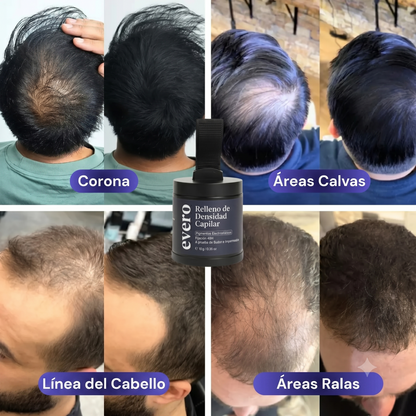 Polvo rellenador para densidad capilar